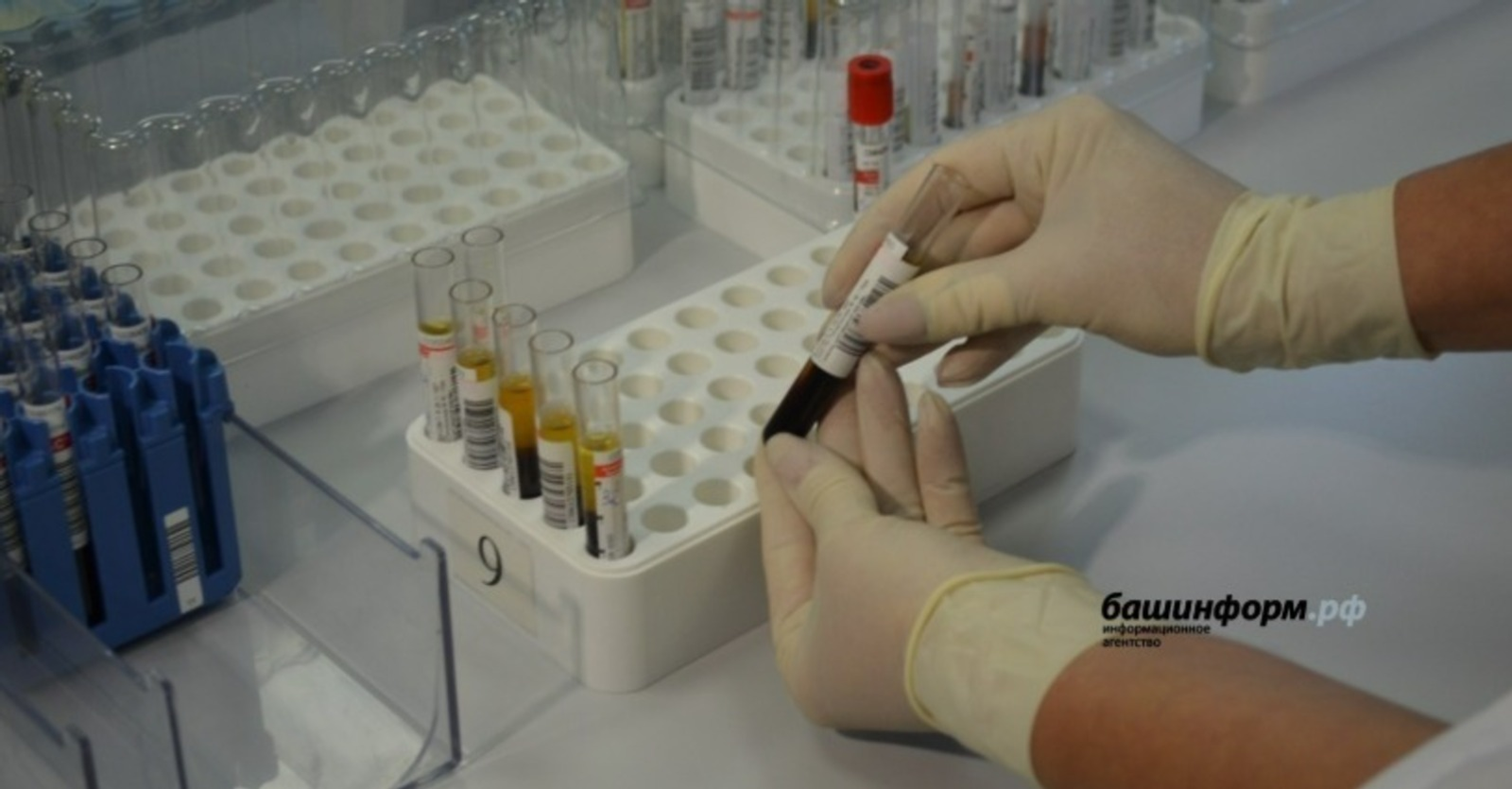 Пятеро жителей Башкирии «привезли» из отпуска лихорадку денге